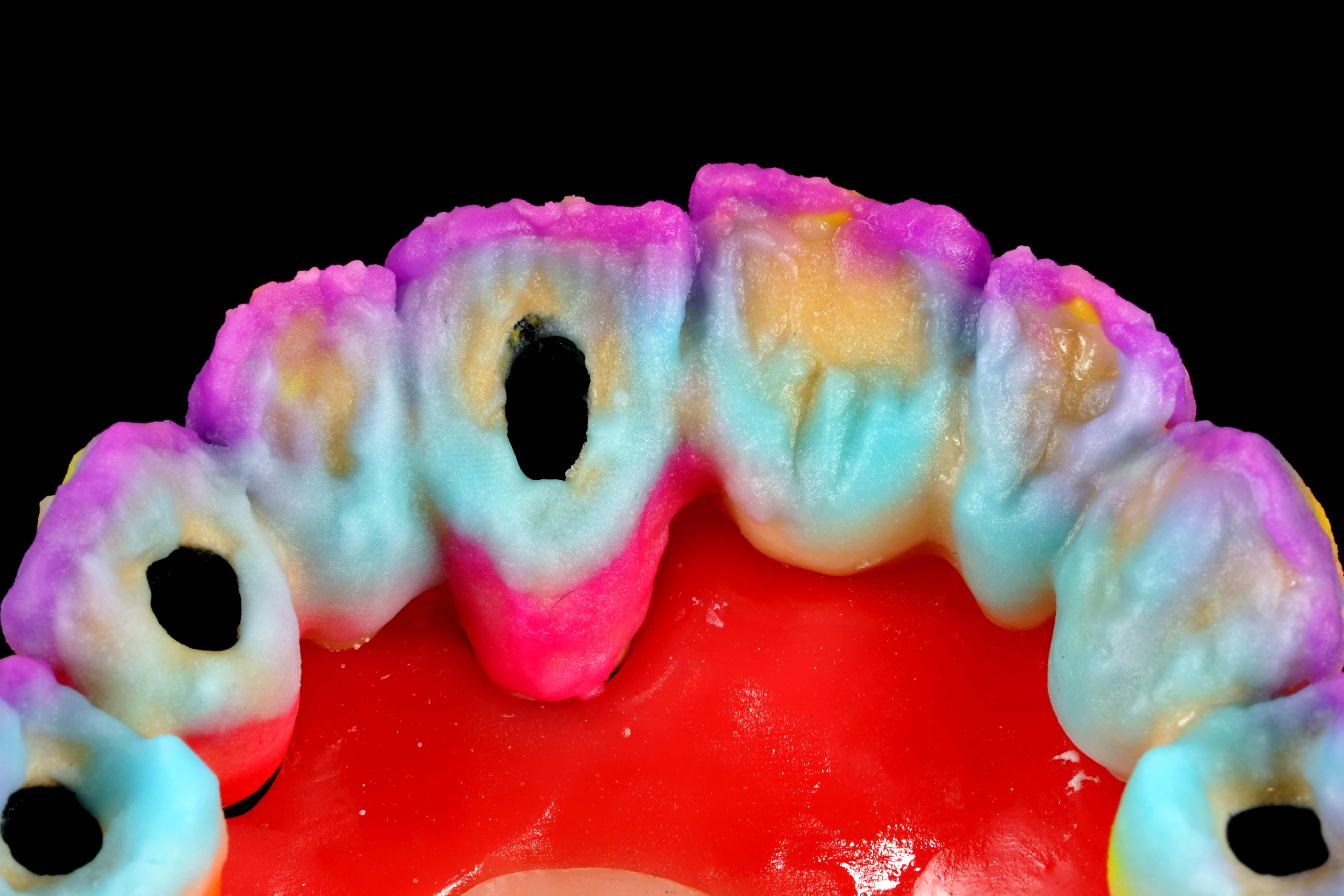 vista palatina ceramizzazione