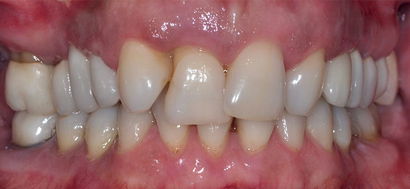 Situazione clinica iniziale