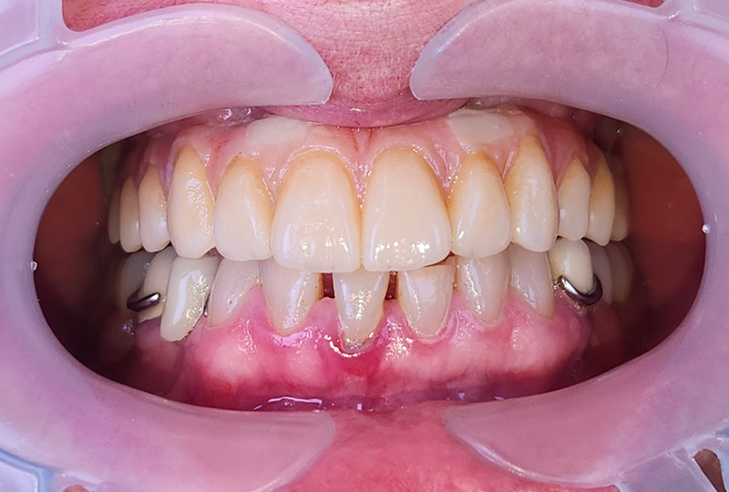 Situazione clinica iniziale