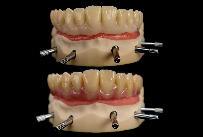 Stampa della parte estetica definitiva e caratterizzazione tramite composito