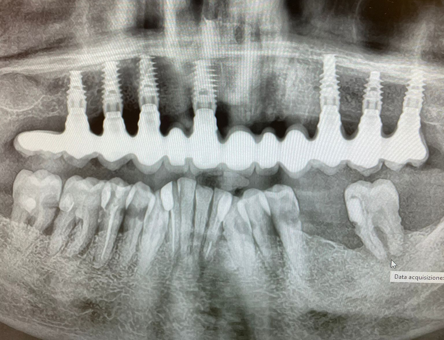 radiografia panoramica