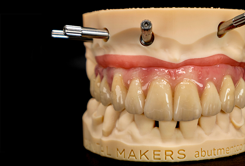 Conclusione delle fasi di laboratorio su modello stampato