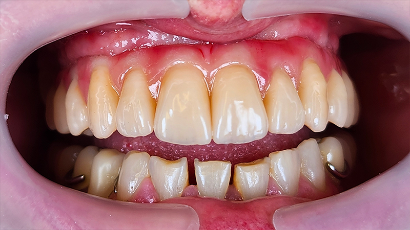 Consegna e RX controllo