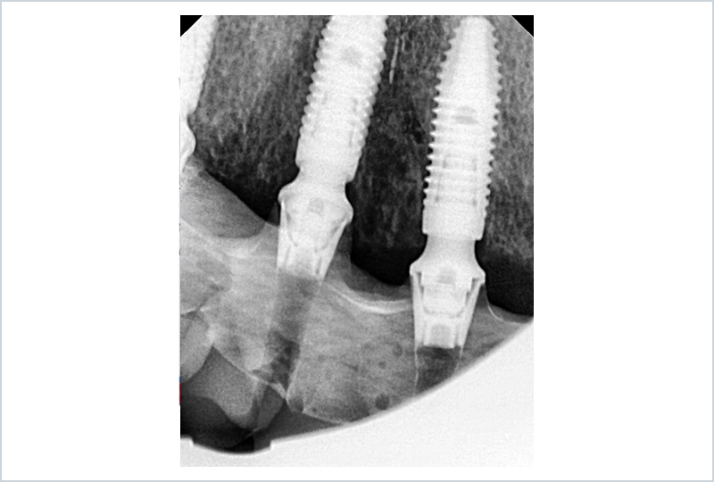 Consegna e RX di controllo