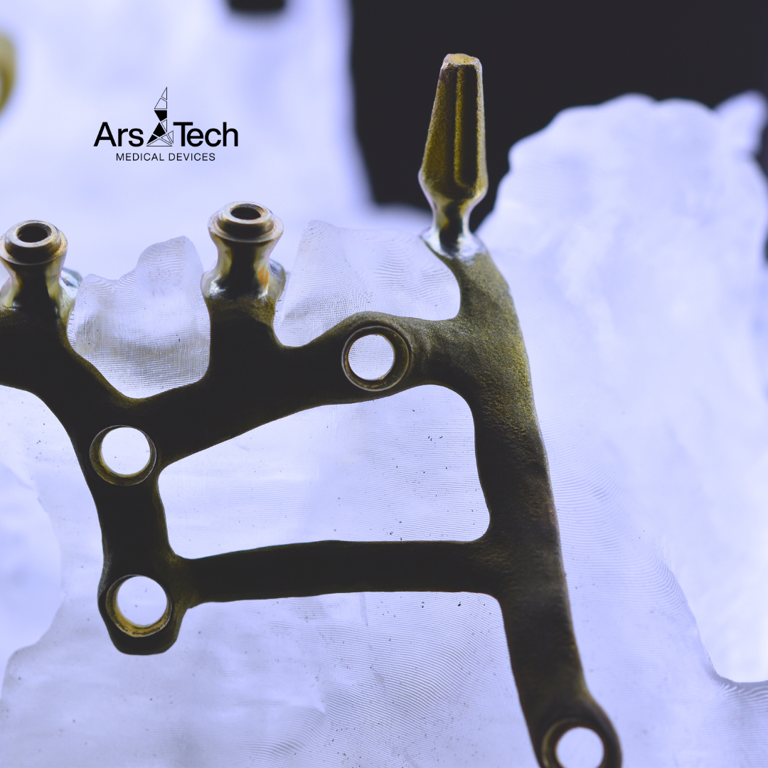 Modello anatomico stampato e impianto Iuxtaosseo stampato in titanio, immagini fornite da Ing M. Bonacina Ars&Tecnology (BG)