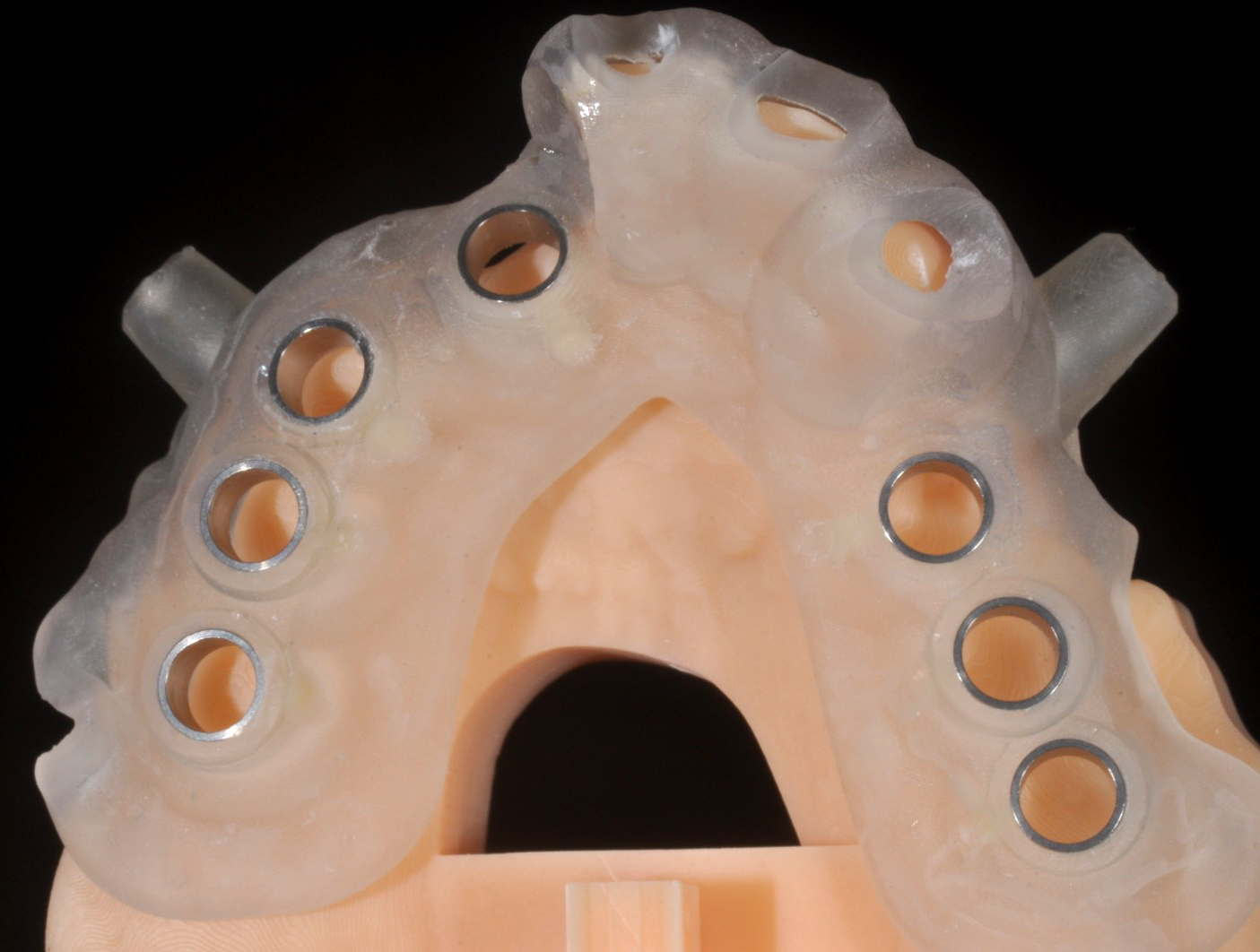 Dima chirurgia guidata