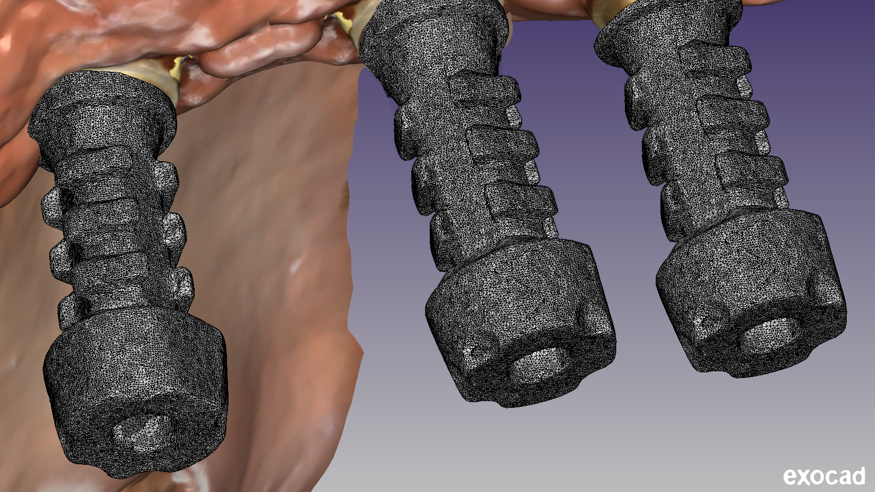 scansione scanTransfer