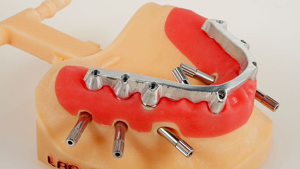 Ferulizzazione di Scan|Transfer