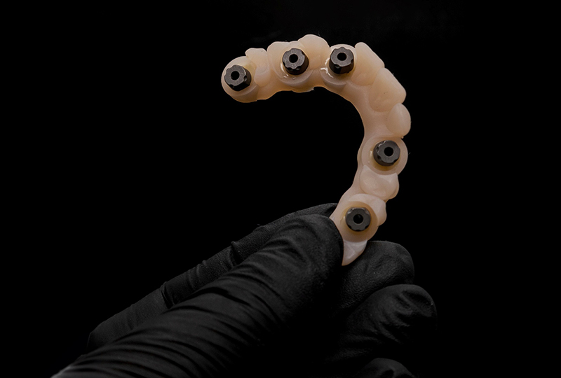 Concetto di Re|Scan: semplificare la scansione permettendo al clinico di aggiungere o corregere aree della scansione fuori dal cavo orale