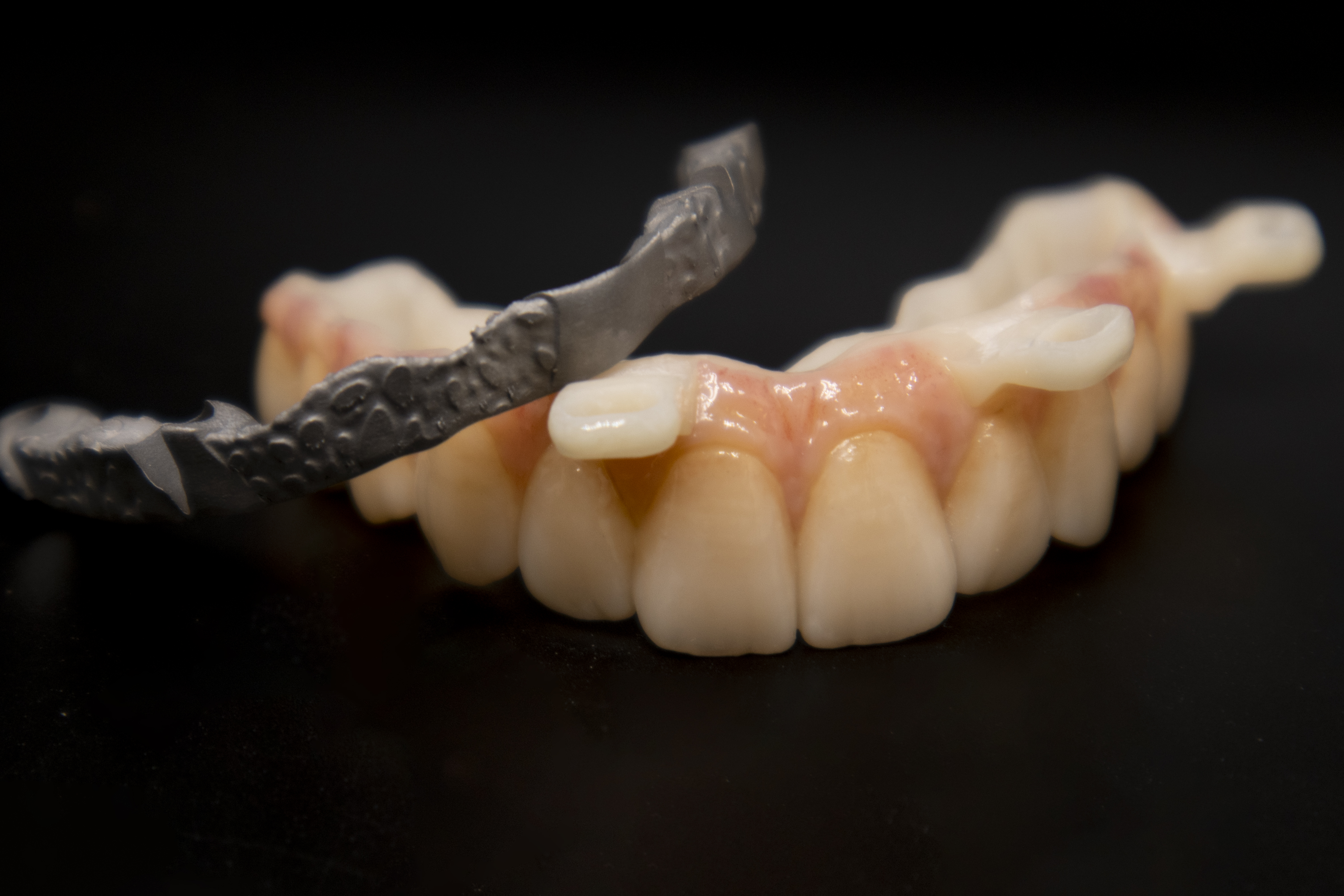 Protesi finita e toronto bridge 1