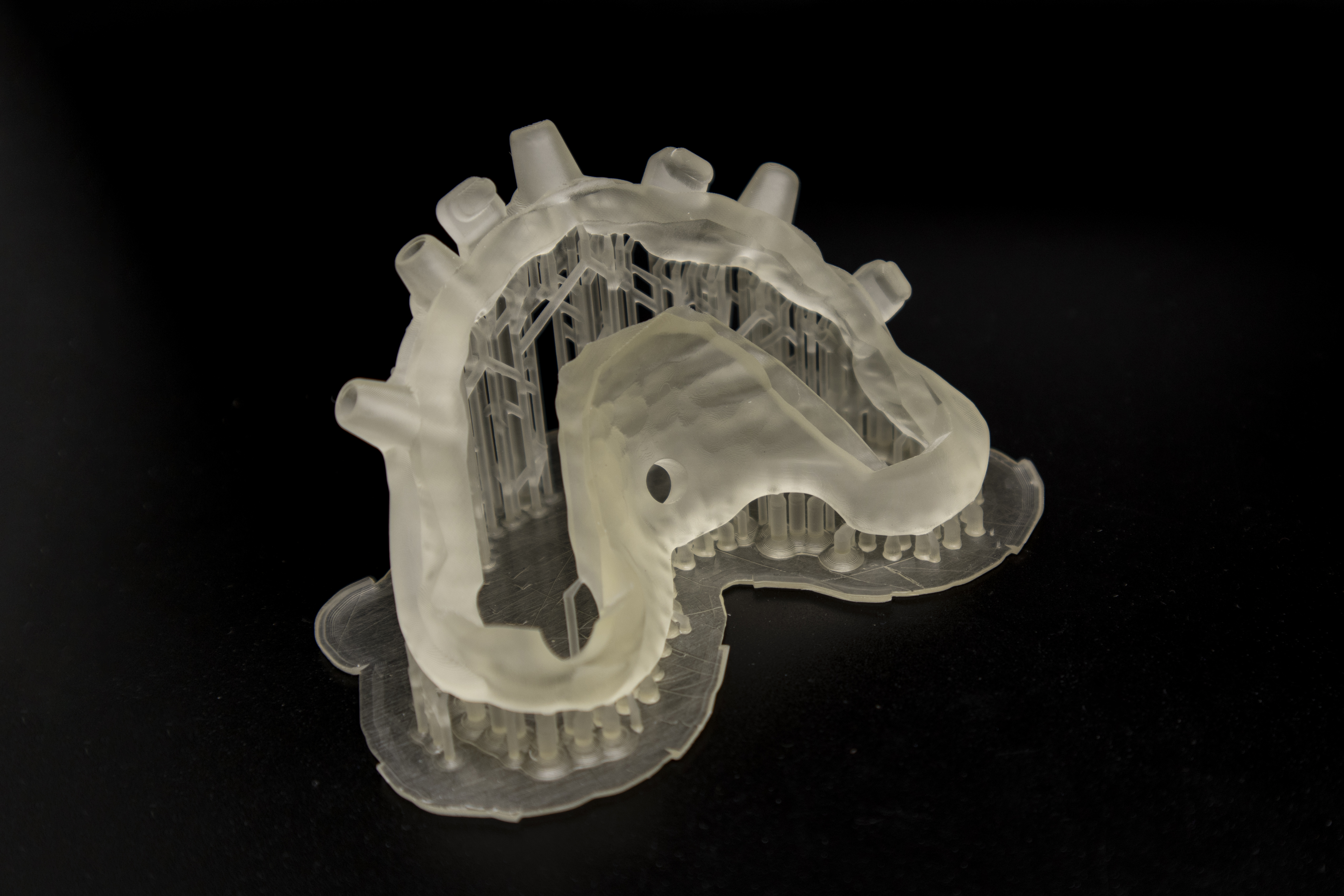 Protesi finita e toronto bridge 2