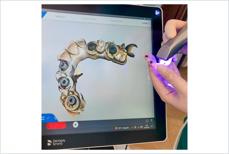 Concetto di Re| Scan: semplificare la scansione permettendo al clinico di aggiungere o correggere aree della scansione fuori dal cavo orale