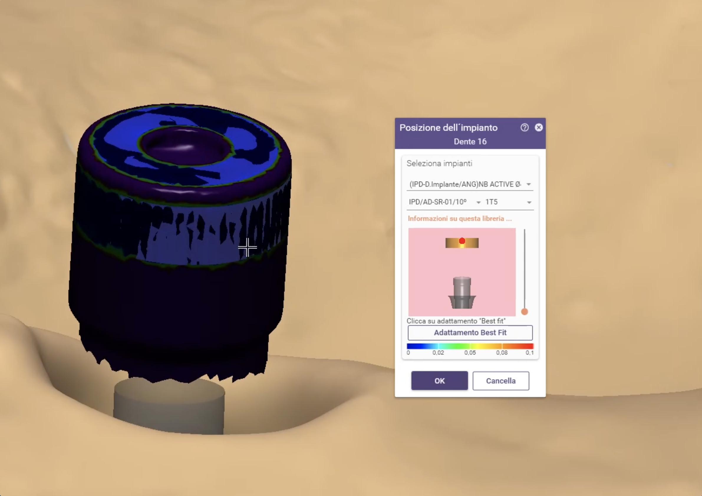 accoppiamento libreria scansione intraorale