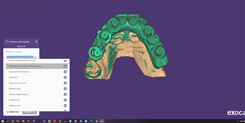 Accoppiamento "Only Top" delle librerie sulla scansione importata in cad 