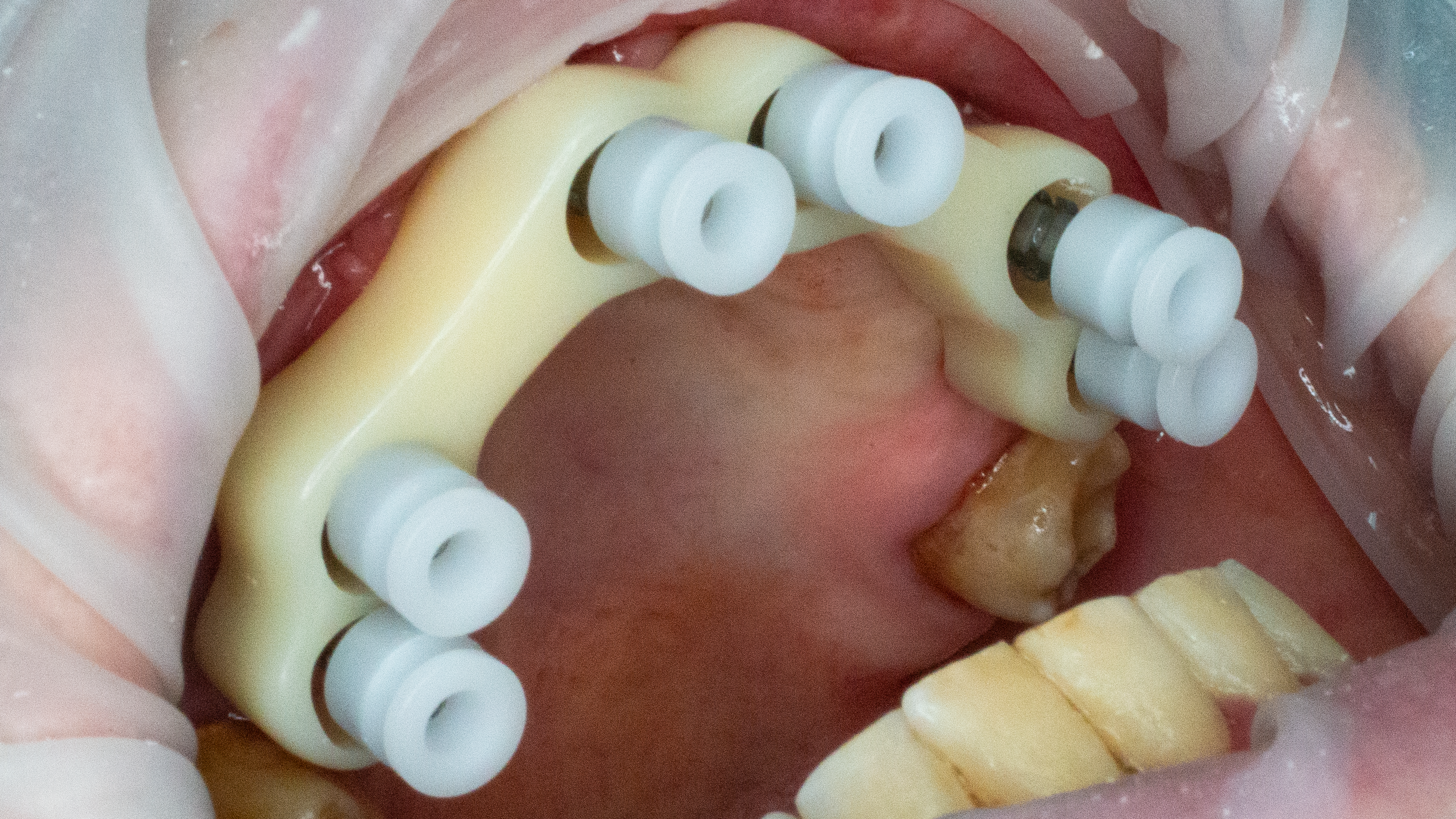 Ferula bloccata con Scan|Transfer