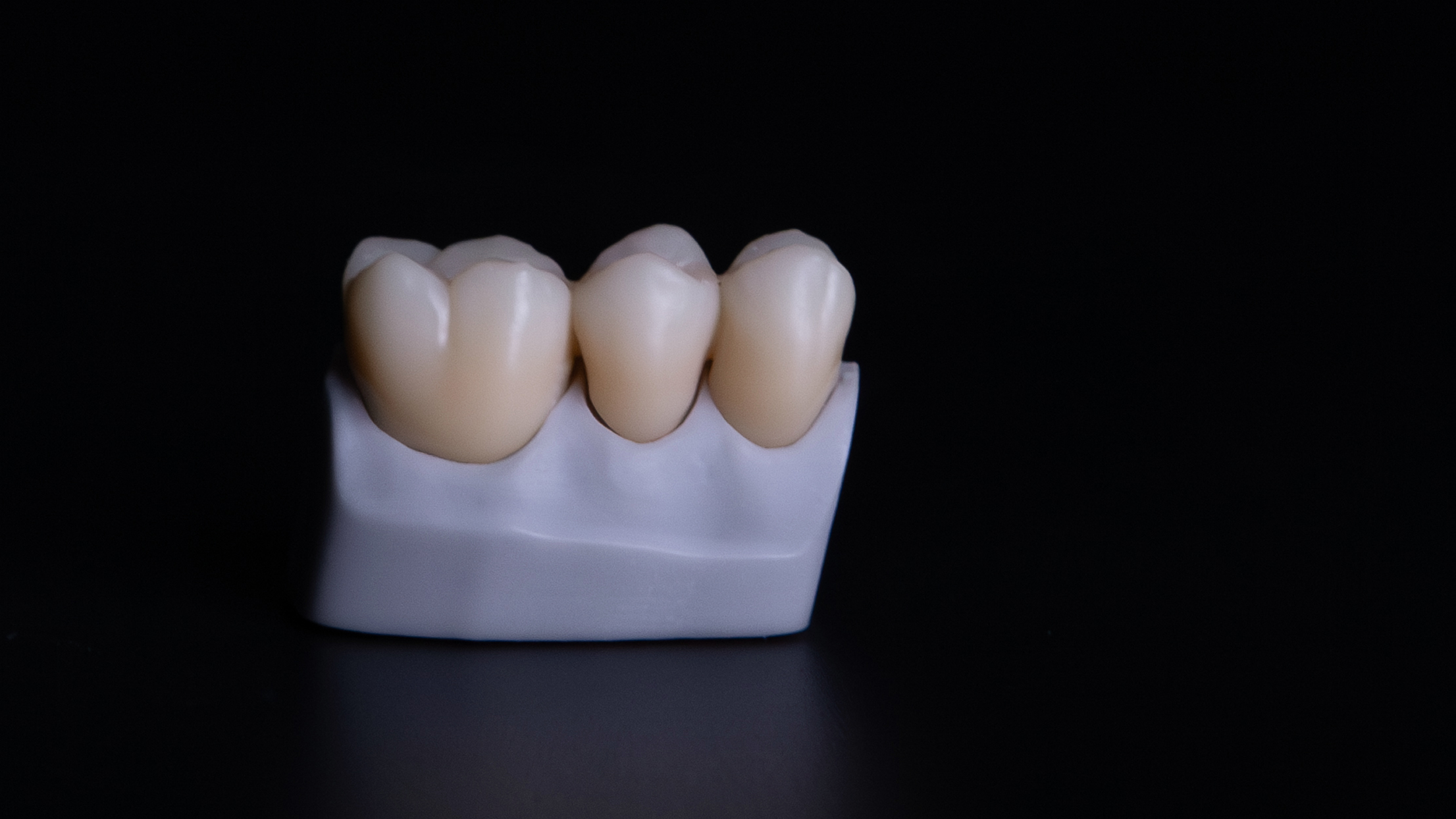 9.Elementi definitivi stampati con D-Fab e Resina Irix max photoshade, Immagine fornita da DWS (VI)