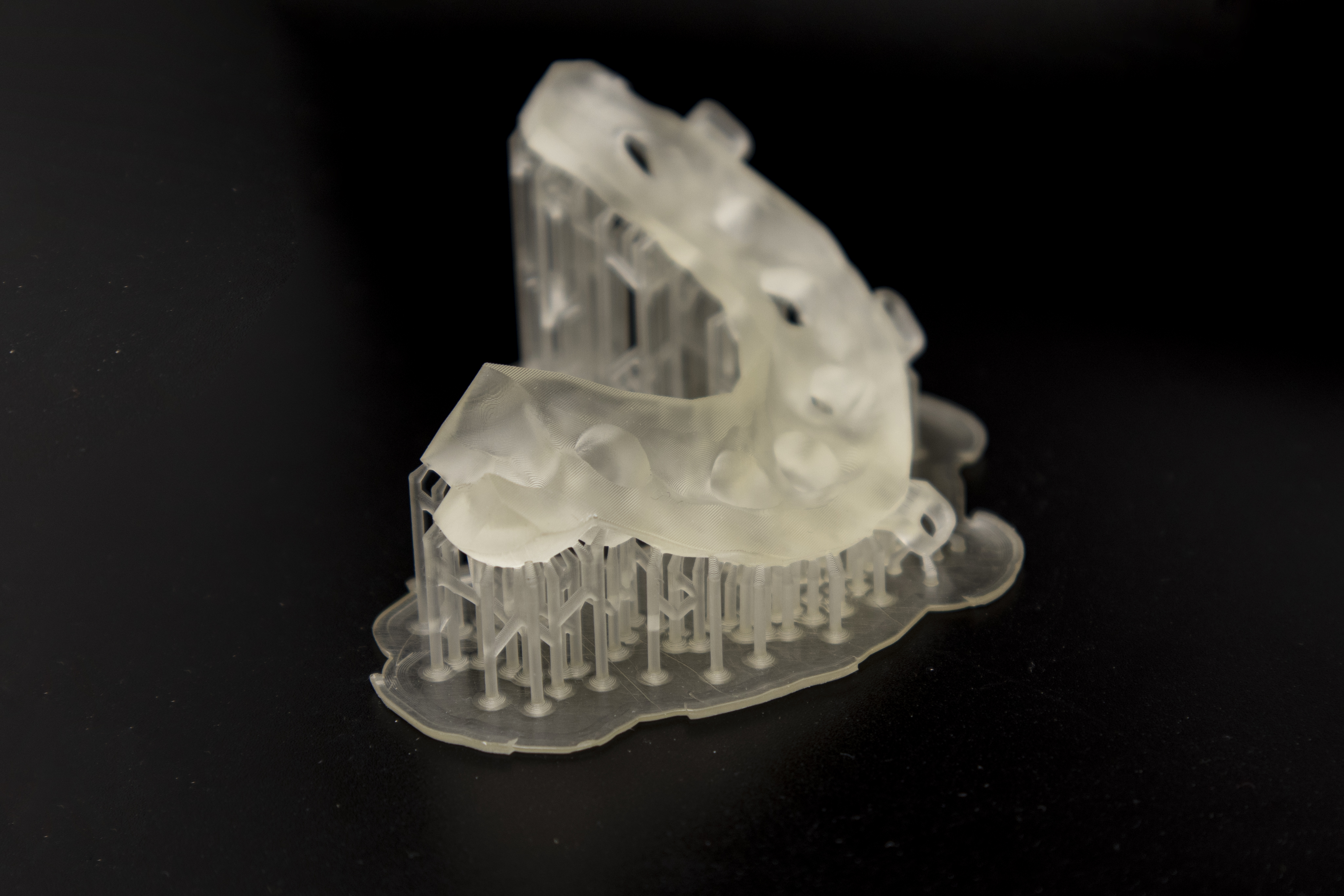 Protesi finita e toronto bridge 4