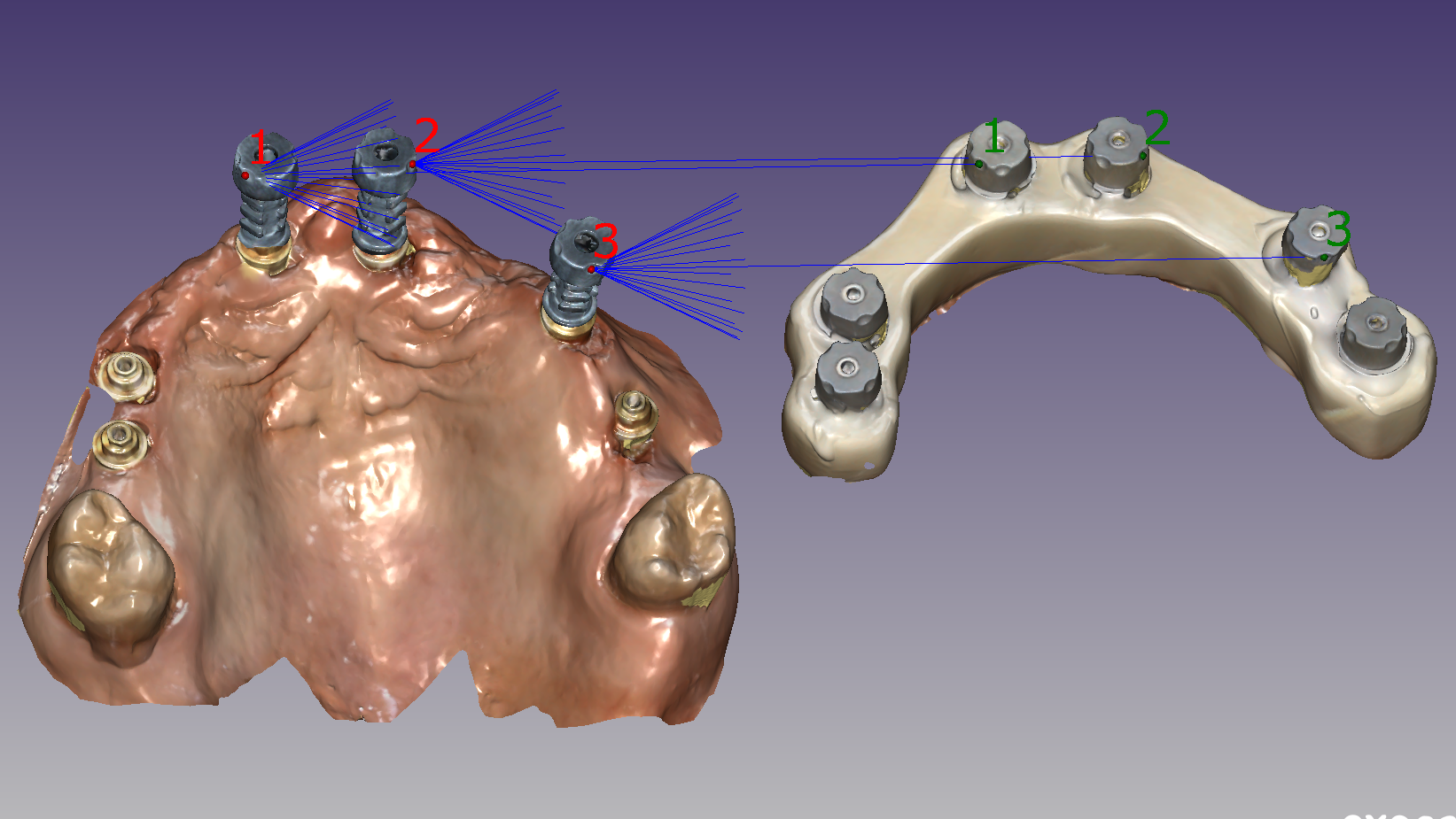 Gestione delle scansioni e applicazioni dei protocolli con Scan|Transfer