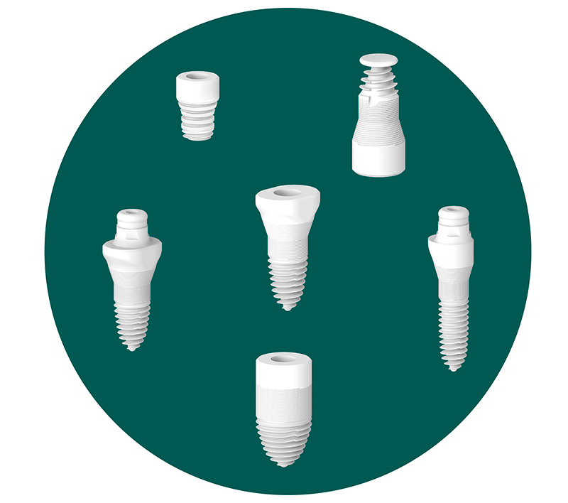 Diverse forme di impianti SDS