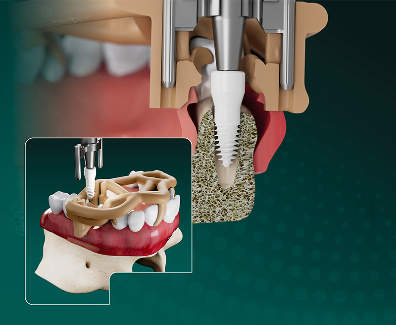 SDS BOX FULL NAVIGATION SYSTEM