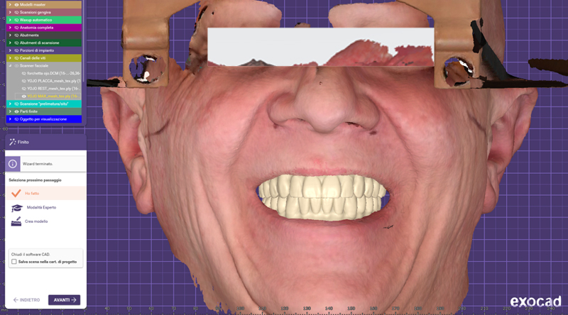 Scansione facciale con repere a massimo sorriso