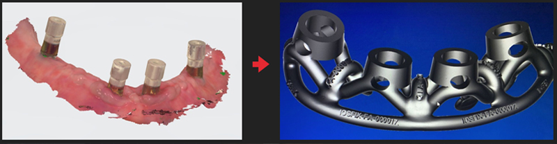 costruzione del framework metallico Ringfix