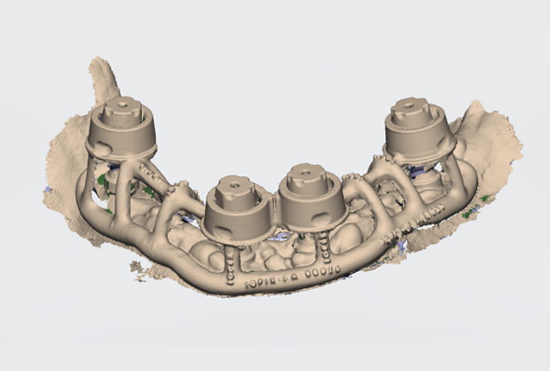scansione Ringfix-Scantransfer