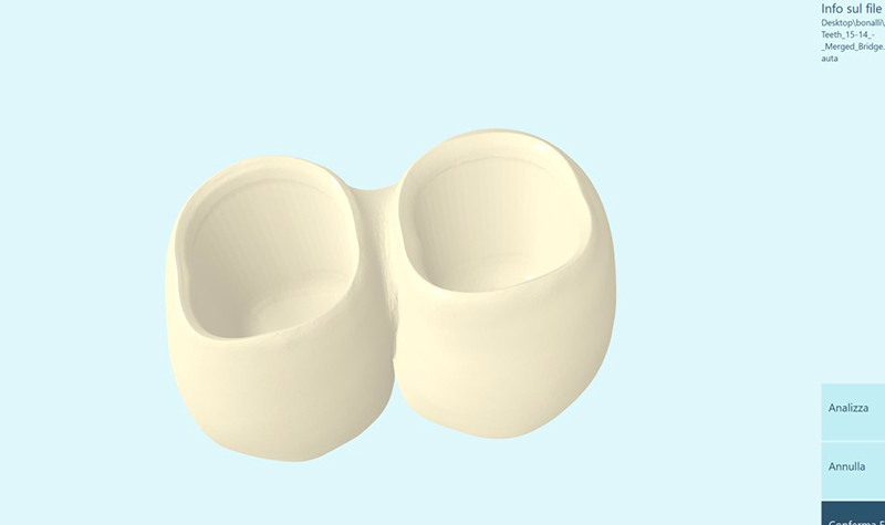 caricamento del file STL del restauro nel software Nauta Photoshade di DWS System