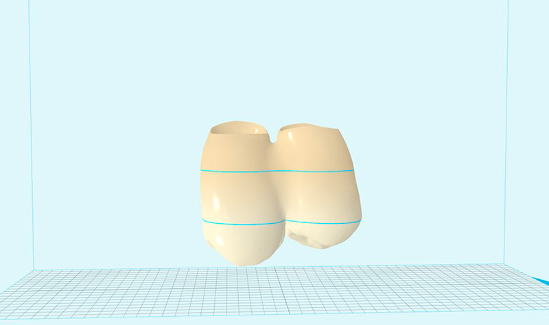 Settaggio dei livelli colore 