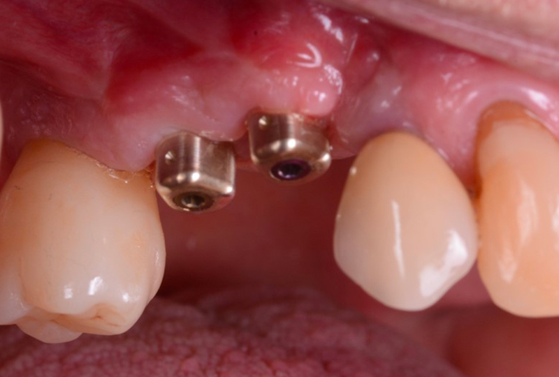 i-Physio in posizione visione laterale