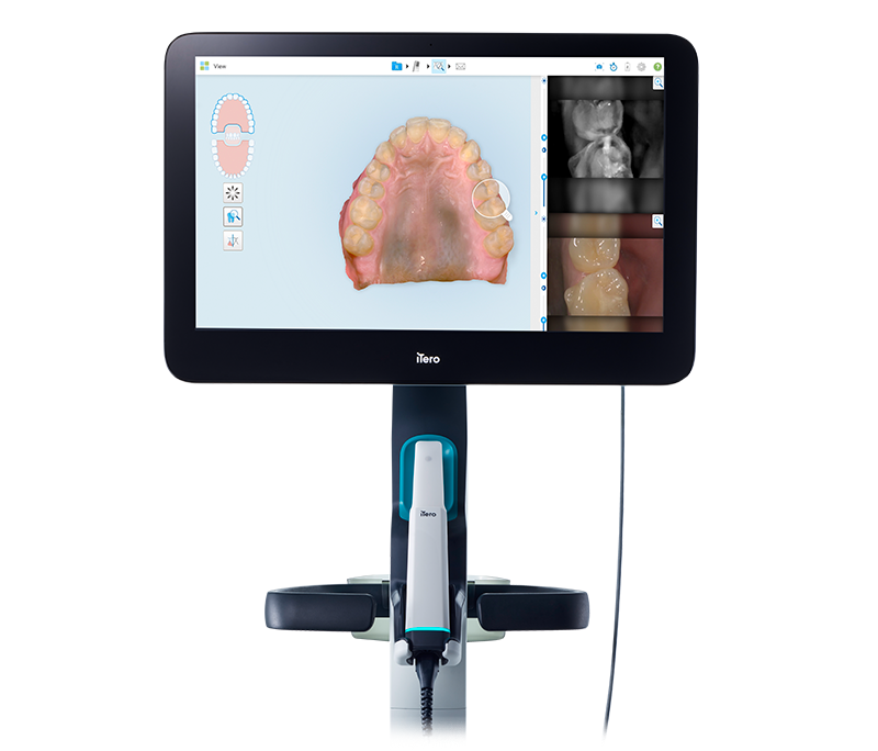 iTero Lumina