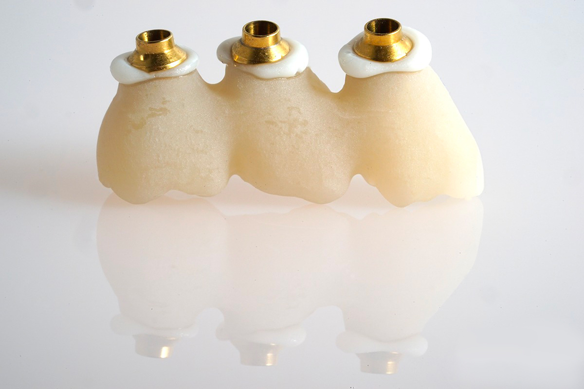 chiave in gesso Re|Scan 2