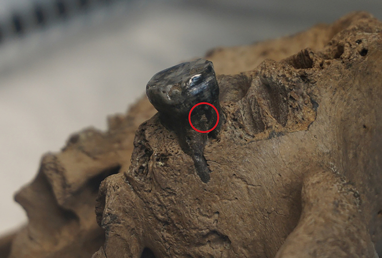 Trataro del cranio di Harbin