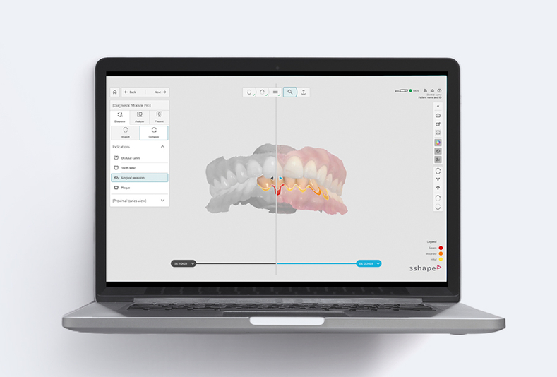 TRIOS DX Plus screen