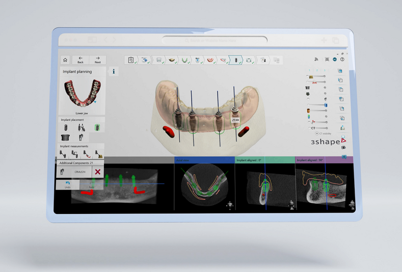 Implant Studio 2026.1