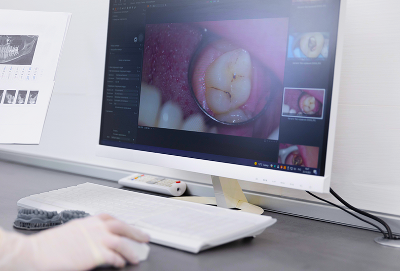 Digital photography e AI