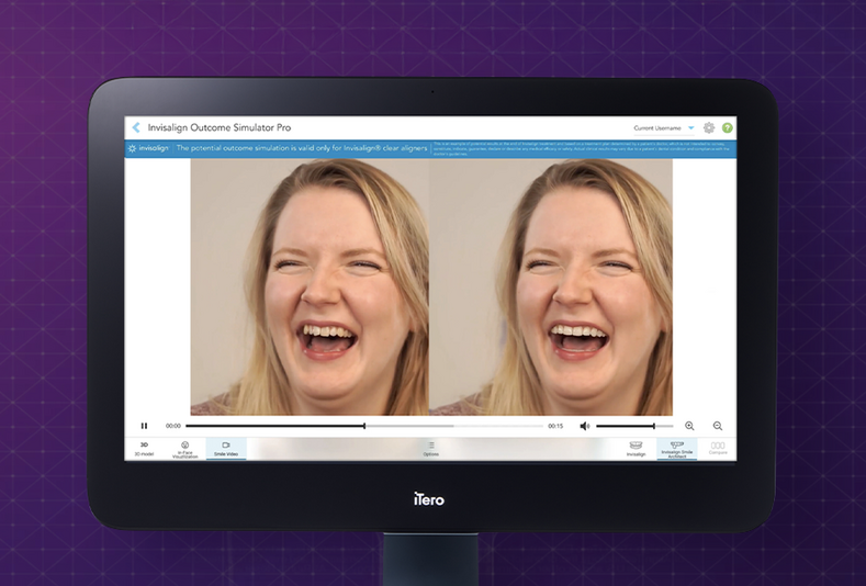 Align Technology annuncia nuove innovazioni per le soluzioni digitali iTero