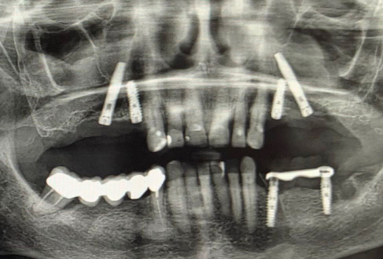 immagine radiografica