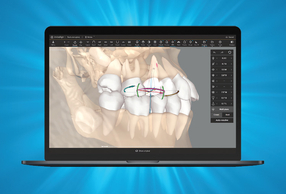 CBCT Invisalign