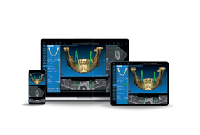 IsoGuide 3.0: la chirurgia Guidata senza limiti