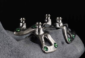 SP4, in implantologia possiamo parlare di quarto millennio