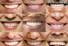 Tante bocche che sorridono