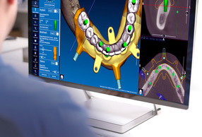 Persona che utilizza il software RealGUIDE™