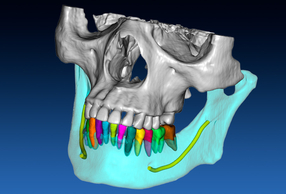 Software RealGUIDE™