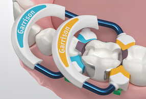 matrici sezionali Strata-G Garrison