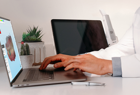 Primo piano mani che utilizzano iTero Design Suite