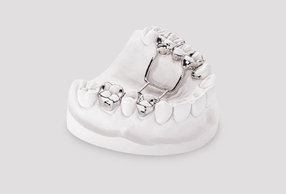 Nuove opportunità con l'ortodonzia digitale in LaserMelting di CADdent