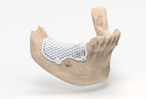 3D-Mesh Custom di BTK