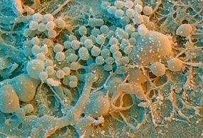 Batteri della placca