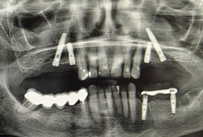 immagine radiografica